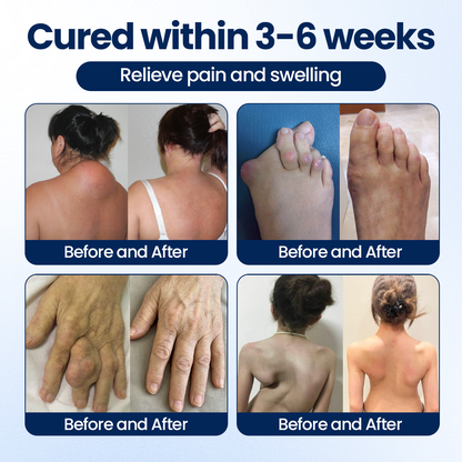🔥New for 2026🔥🎁 Final Hour: Limited Stock Remaining